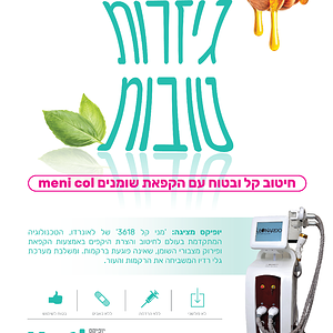 מודעה יופיקס גיזרות-01